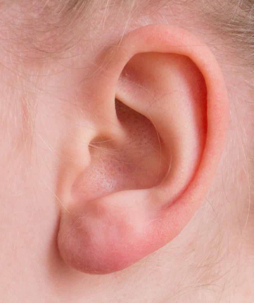 como cuidar nuestros oídos